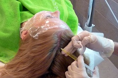 плазмотерапия волос в Краснодаре