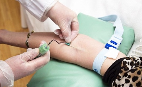Плазмолифтинг - забор крови в пробирку